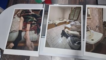Ампутираха пръсти и част от петата на 89-годишна от „Дома на ужасите“
